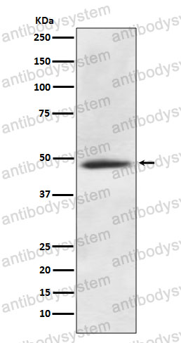 Anti-CAMK2A Antibody (R2P02)