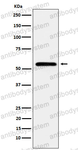 Anti-CAMK2A Antibody (R2P05)
