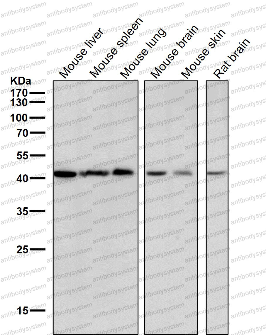 Anti-CABP1 Antibody (R1B77)