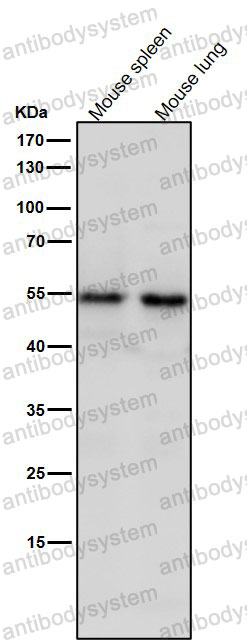Anti-SEC62 Antibody (R1B81)