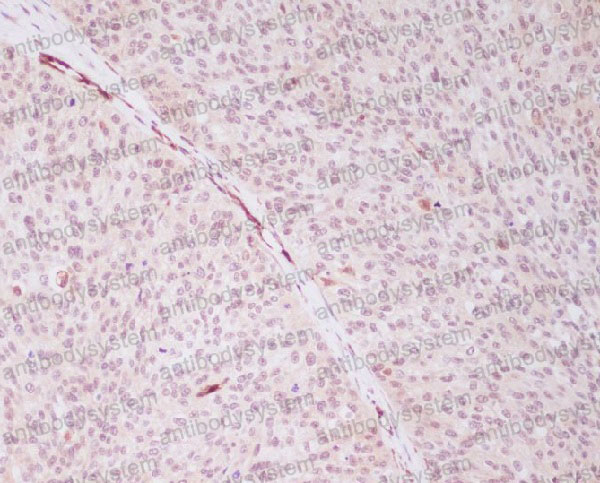 Anti-PRPF19 Antibody (R2P07)