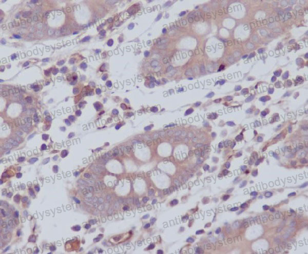 Anti-WASF2 Antibody (R2P08)