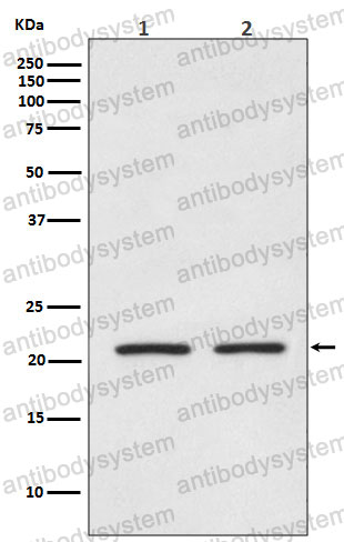 Anti-AKAP14 Antibody (R2P09)