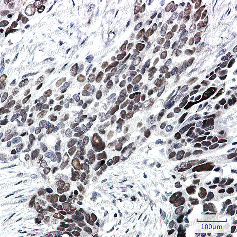 Anti-TCF7L2 Antibody (R2P12)