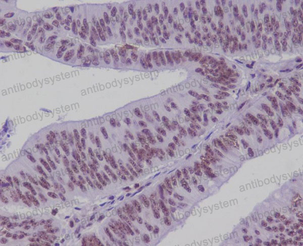 Anti-TCF7L2 Antibody (R2P11)