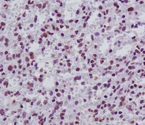 Anti-FANCD2 Antibody (R2P13)