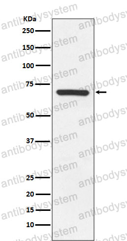Anti-MAP3K3 Antibody (R2P15)