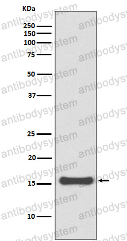 Anti-SUMO4 Antibody (R2P16)