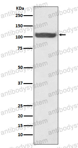 Anti-HSPH1 Antibody (R2P17)