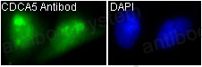 Anti-CDCA5 Antibody (R2P18)