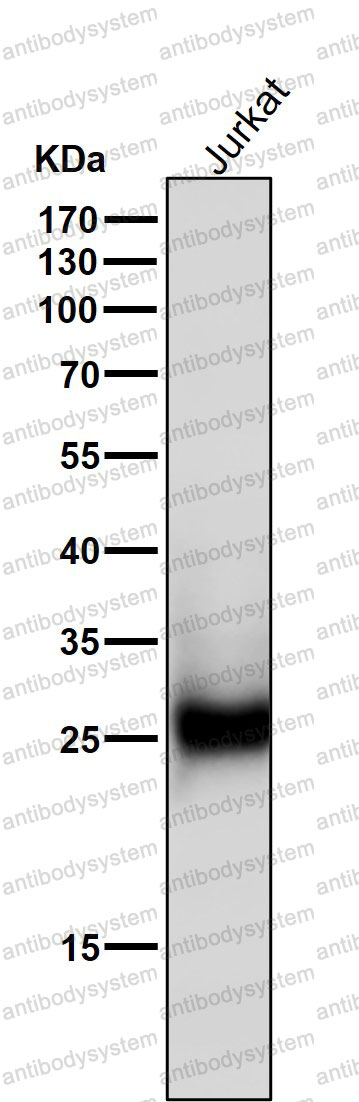 Anti-ZNRF2 Antibody (R2P20)