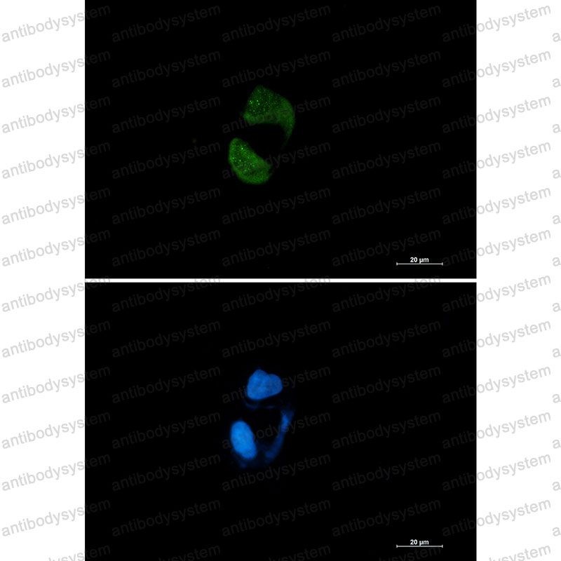 Anti-AGO2 Antibody (R2P22)