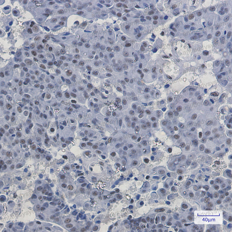Anti-PABPN1 Antibody (R2P24)