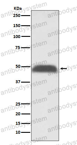 Anti-PABPN1 Antibody (R2P23)