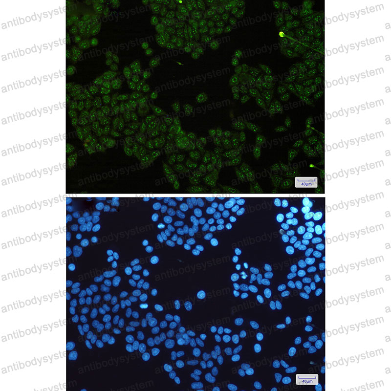 Anti-IKBKG Antibody (R2P26)