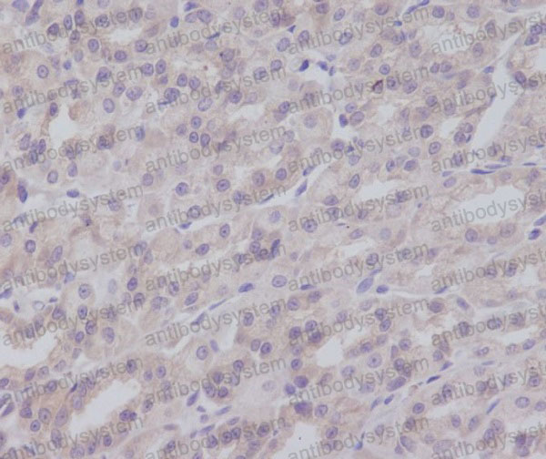 Anti-IKBKG Antibody (R2P25)