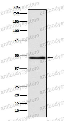 Anti-SERPINA9 Antibody (R2P27)