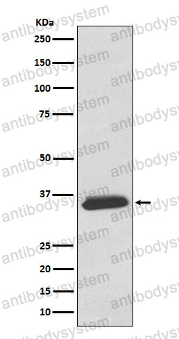 Anti-SGCD Antibody (R2P28)