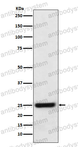 Anti-HSD17B10 Antibody (R2P29)