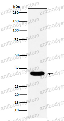 Anti-DAZL Antibody (R2P31)