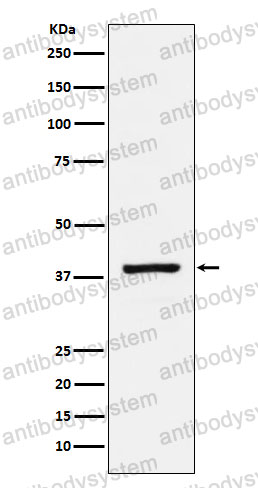 Anti-RASSF1 Antibody (R2P32)