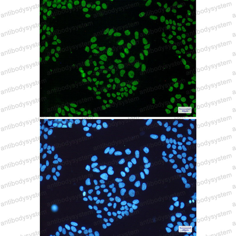 Anti-THOC1 Antibody (R2P35)