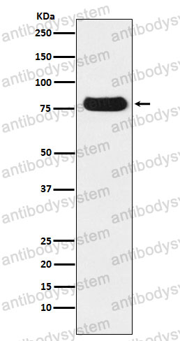 Anti-THOC1 Antibody (R2P34)