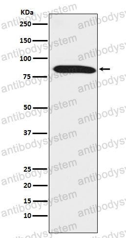 Anti-DNAI1 Antibody (R2P36)