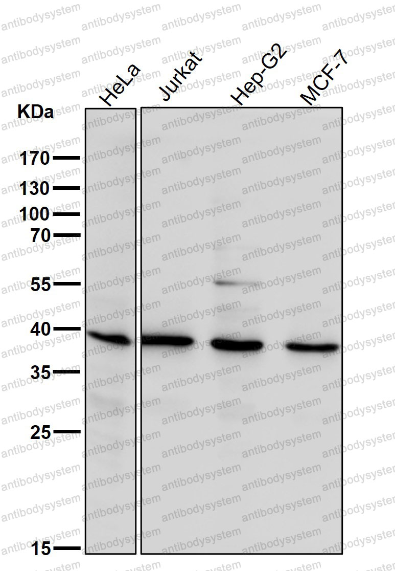 Anti-LPAR1 Antibody (R2P37)