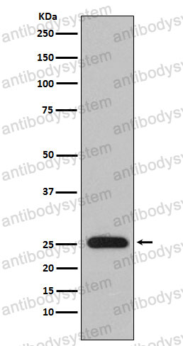 Anti-Human Lambda Light Chain Antibody (R2P38)