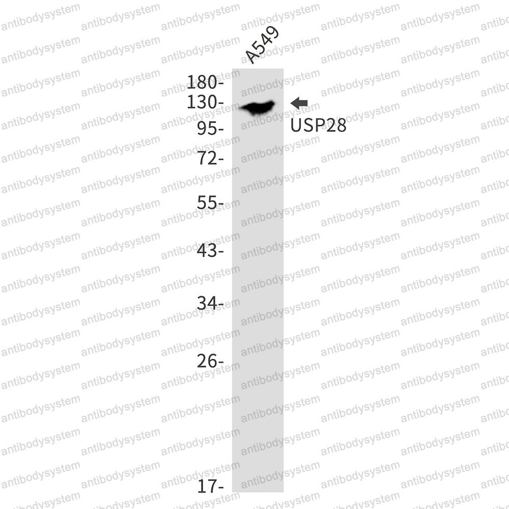 Anti-USP28 Antibody (R2P41)