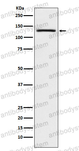 Anti-USP28 Antibody (R2P39)