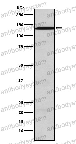 Anti-USP28 Antibody (R2P40)