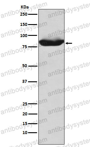 Anti-MALT1 Antibody (R2P43)