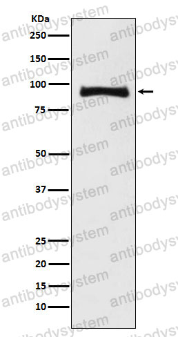 Anti-MALT1 Antibody (R2P42)