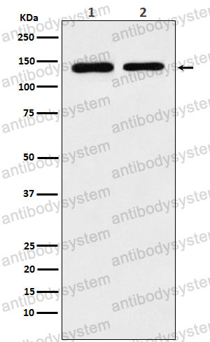 Anti-STAG2 Antibody (R2P44)