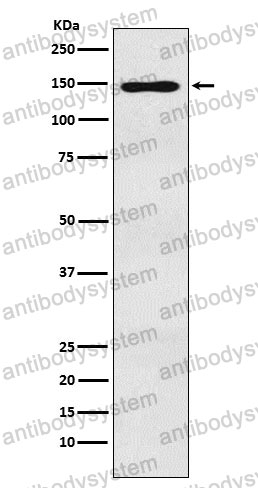 Anti-MYBBP1A Antibody (R2P45)