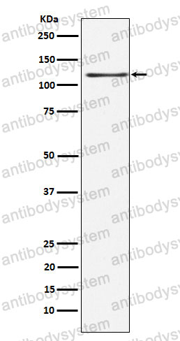 Anti-KSR1 Antibody (R2P46)