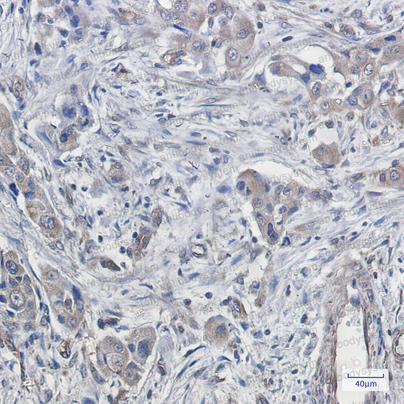 Anti-DTL Antibody (R2P48)