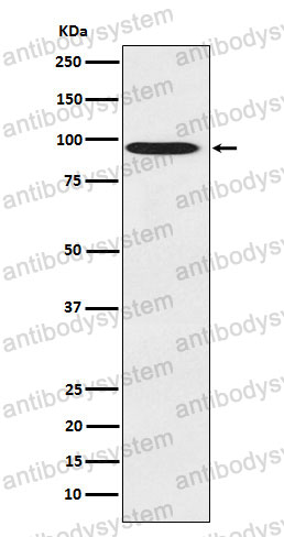 Anti-DTL Antibody (R2P47)