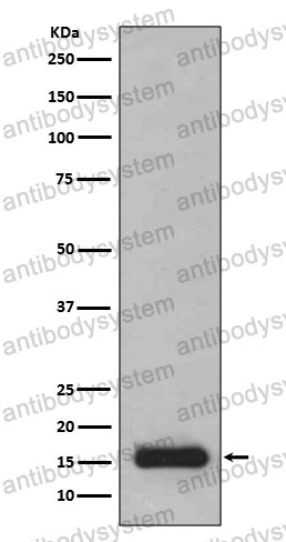 Anti-PFDN5 Antibody (R2P49)