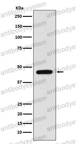 Anti-WIPI1 Antibody (R2P50)