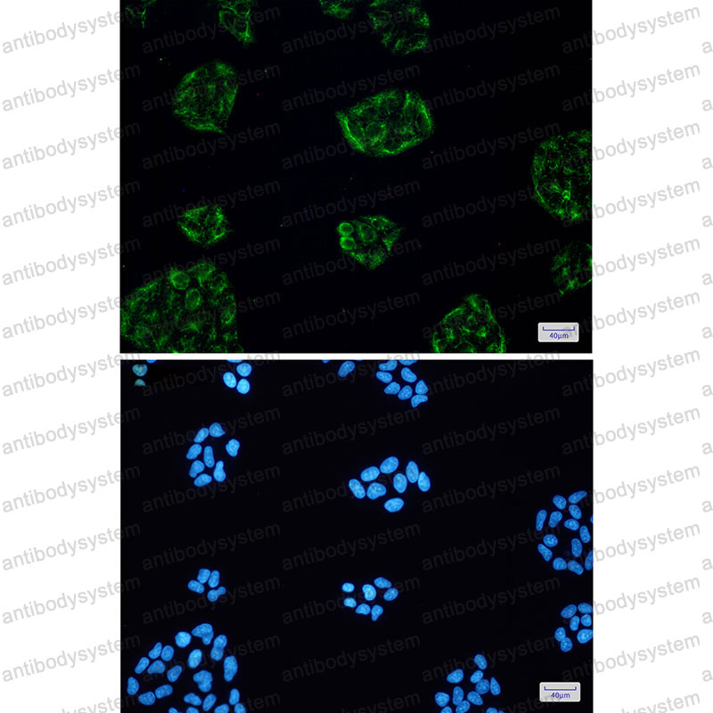 Anti-KCTD9 Antibody (R2P54)