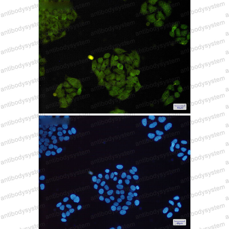 Anti-BRAT1 Antibody (R2P56)