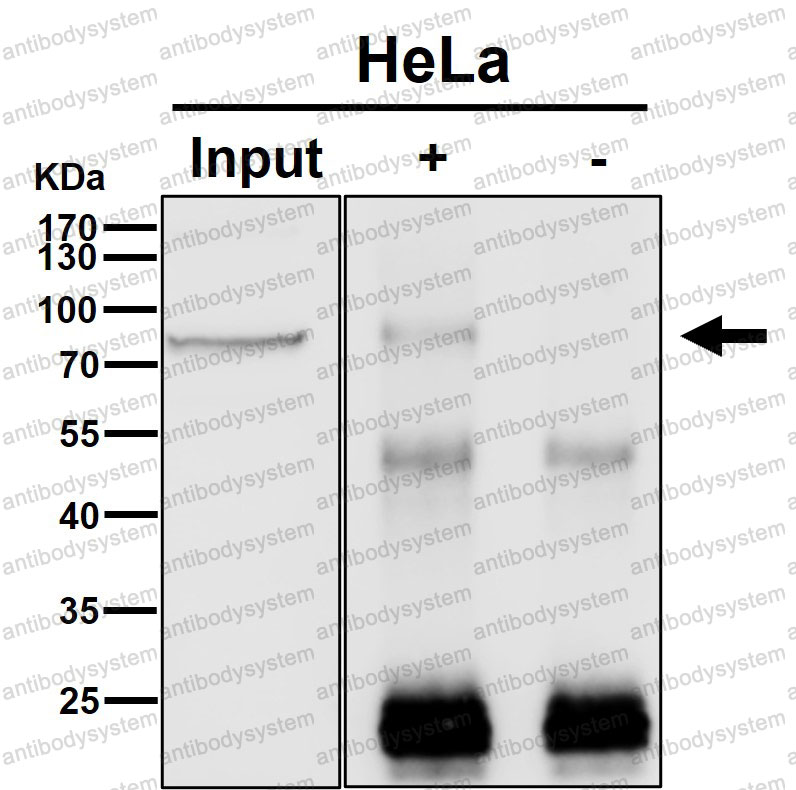 Anti-BRAT1 Antibody (R2P55)