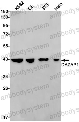 Anti-DAZAP1 Antibody (R2P59)