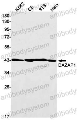 Anti-DAZAP1 Antibody (R2P58)