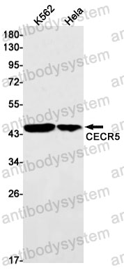 Anti-HDHD5 Antibody (R2P61)