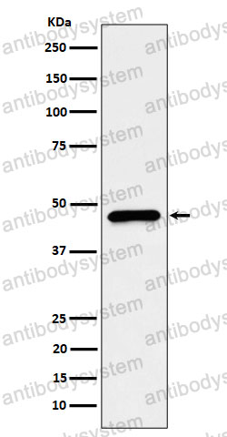 Anti-HDHD5 Antibody (R2P60)