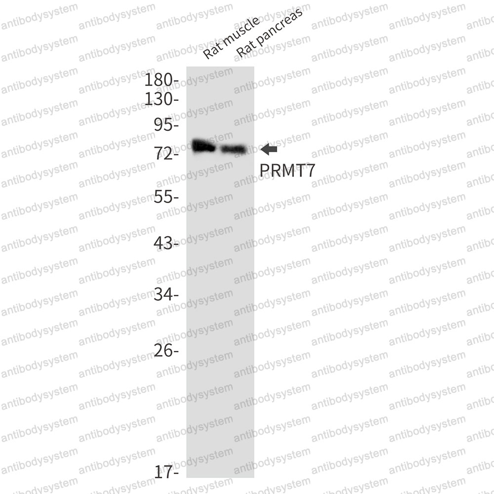 Anti-PRMT7 Antibody (R2P63)